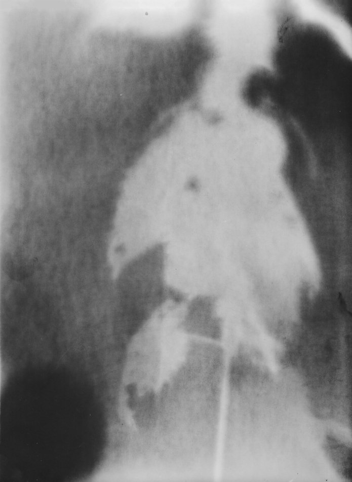 Emslander julia leaves fotogramm gregor hildebrandt youngartist